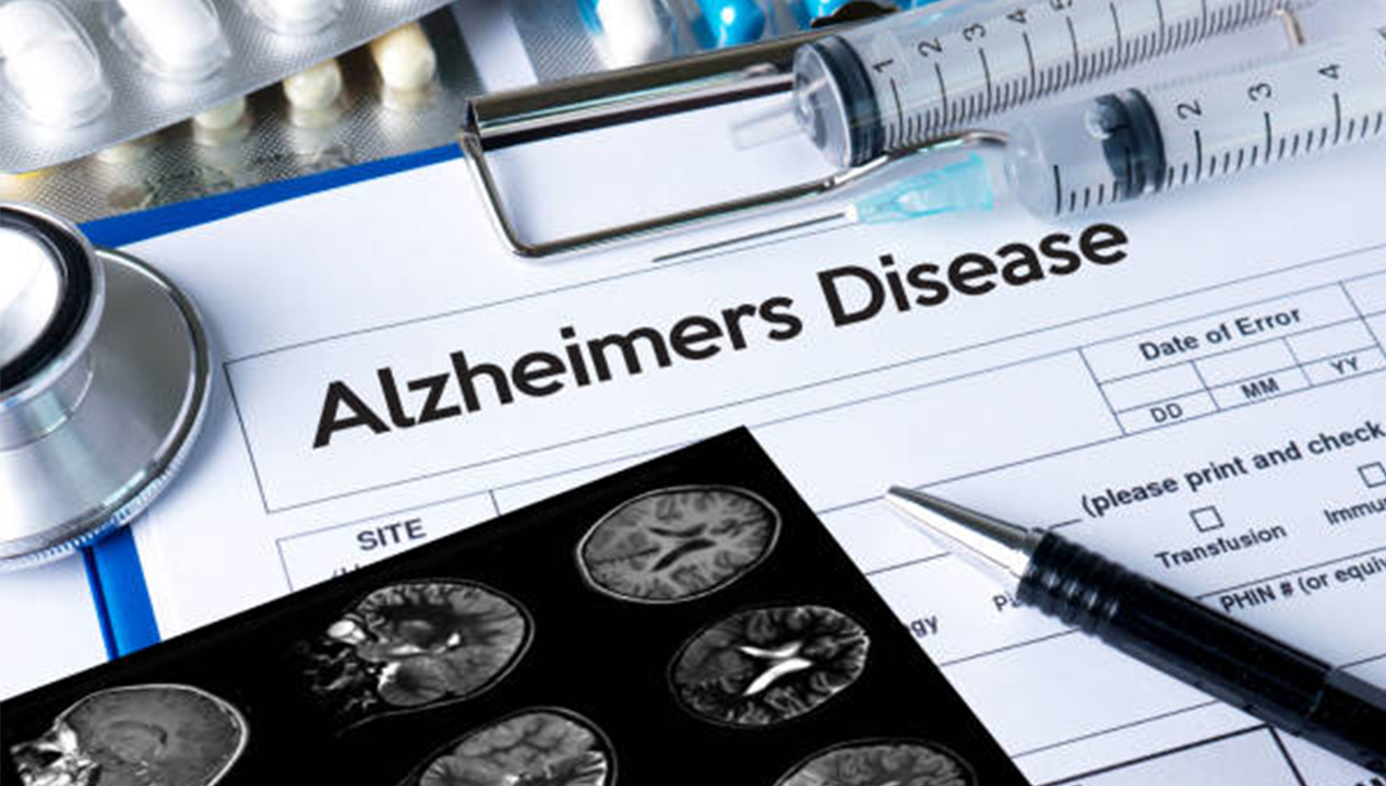 Apakah Alzheimer Bisa Disembuhkan? Ini Penjelasan Medis dan Pilihan Obatnya