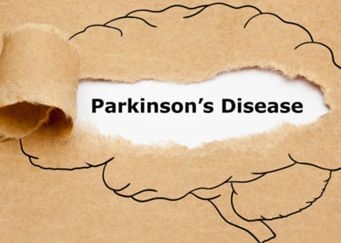 Parkinson Menyerang Otak, Kenali Penyebab, Gejala dan Faktor Risikonya