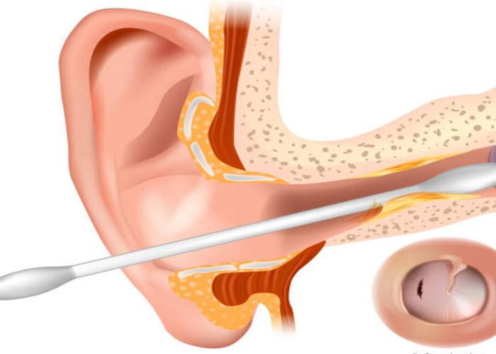 Membersihkan Hidung dan Telinga Saat Puasa, Apakah Membatalkan? Ini Penjelasan 4 Mazhab dan Ulama Kontemporer