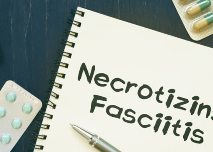 Mengenal Necrotizing Fasciitis: Penyebab, Gejala Awal, dan Apakah Bisa Disembuhkan?