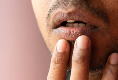 Cara Mengatasi Bibir Pecah-Pecah Saat Puasa: Tips Ampuh Agar Tetap Lembap dan Sehat