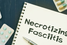 Mengenal Necrotizing Fasciitis: Penyebab, Gejala Awal, dan Apakah Bisa Disembuhkan?