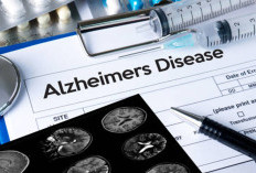 Apakah Alzheimer Bisa Disembuhkan? Ini Penjelasan Medis dan Pilihan Obatnya