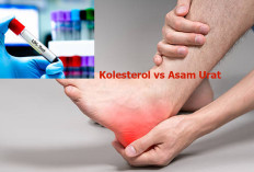 Kolesterol Tinggi dan Asam Urat Sering Muncul Bersamaan, Mana yang Harus Diobati?