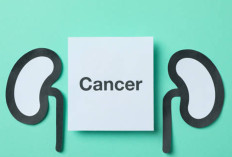 Bahaya Kanker Ginjal yang Sering Tak Disadari: Gejala, Pencegahan, dan Terapi